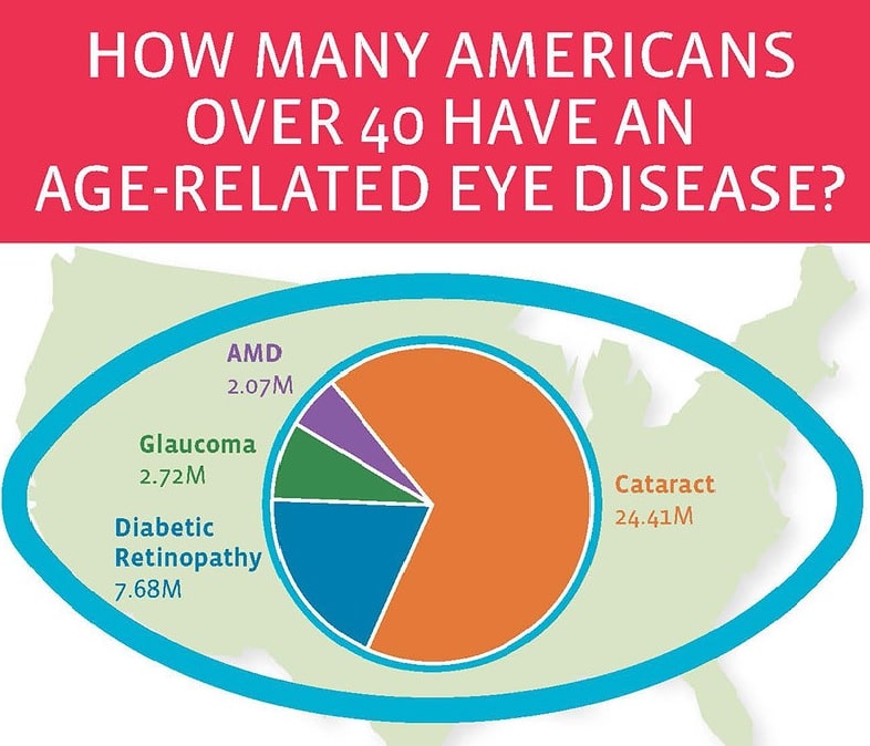 eye-disease-statistics